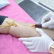 Examen de sangre cáncer tumor estudio ciencia