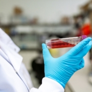 Examen de sangre análisis en el laboratorio equipamiento