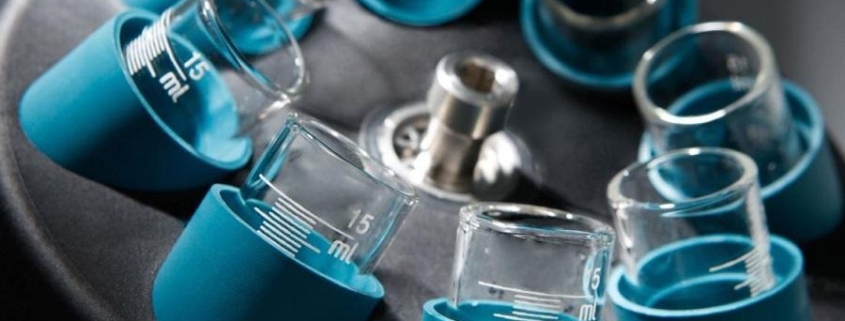 Centrífuga de laboratorio con tubos de ensayo