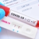 Test PCR en paciente Covid pandemia análisis de laboratorio