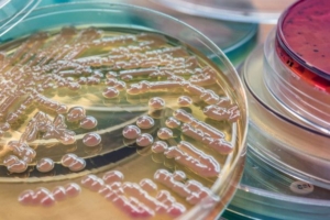 Colonias bacterianas en un plato petri de laboratorio