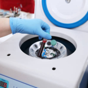 Centrífuga de laboratorio para la separación de muestras líquidas