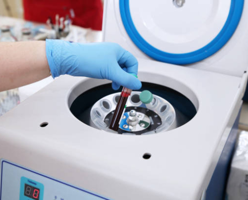 Centrífuga de laboratorio para la separación de muestras líquidas