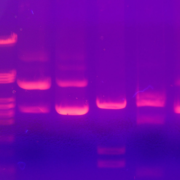 Electroforesis imágenes en gel para análisis