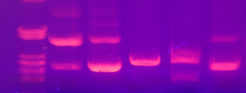 Electroforesis imágenes en gel para análisis