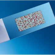 Plataforma de microarray para análisis