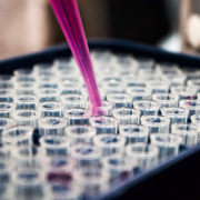 investigación epidemiológica equipos de laboratorio análisis virus