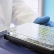 Lector de microplacas equipos de laboratorio analisis