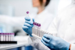 Error en el laboratorio como reaccionar equipos de laboratorio metodología paso a paso