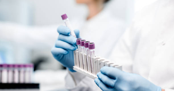 Error en el laboratorio como reaccionar equipos de laboratorio metodología paso a paso
