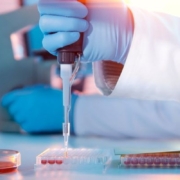 Pipeta de laboratorio manejo de líquidos equipos de laboratorio