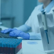 Pipeteo equipos de laboratorio pipeta manejo de líquidos