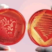 Cultivo celular equipos de laboratorio análisis ciencia