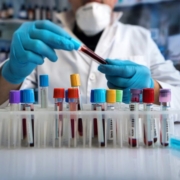 Errores de diagnóstico en el laboratorio equipos de laboratorio ciencias análisis