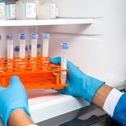 Ultrafreezer de laboratorio análisis equipos de laboratorio ciencia