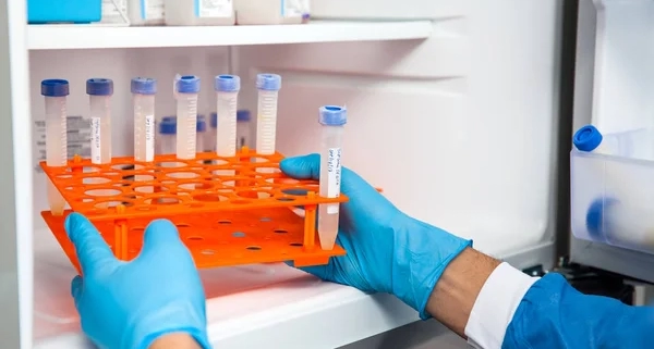 Ultrafreezer de laboratorio análisis equipos de laboratorio ciencia