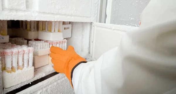 Freezer de laboratorio equipos de laboratorio análisis ciencia