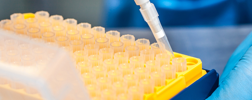 Pipeta automatizada equipos de laboratorio análisis ciencia