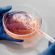 Microbiología, contador de colonias, portaobjetos, colonias
