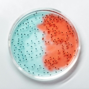 Microbiología, contador de colonias, portaobjetos, colonias
