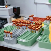 Microbiología, contador de colonias, portaobjetos, colonias